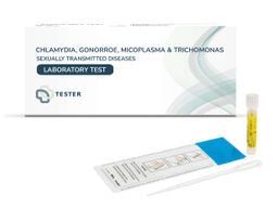 Test Chlamydia, Gonorrhée, Trichomonas et Mycoplasmes (homme) - échantillon d'urine