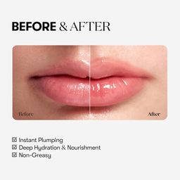 VT COSMETICS Reedle Shot Lip Plumper Beginner