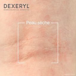Dexeryl Crème Emolliente | Traitement Peaux Sèches Atopiques Visage Et Corps
