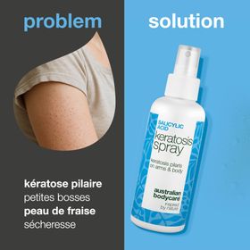 Australian Bodycare Spray Keratosis Pilaris