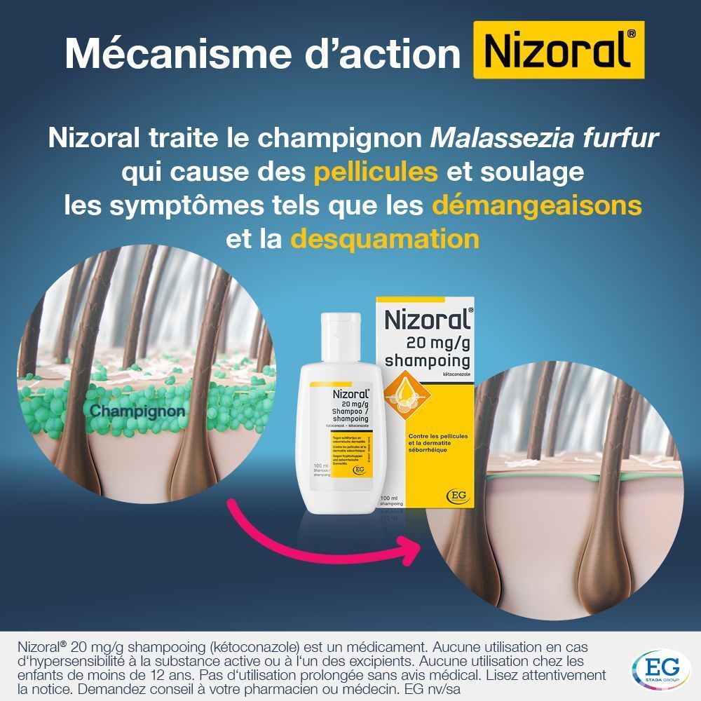 Flacon et boîte de shampooing Nizoral. Texte: 20 mg/g Shampooing. Contre les pellicules et la dermatite séborrhéique.