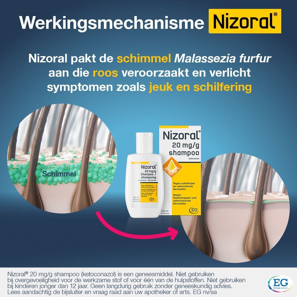 Fles en doos Nizoral shampoo. Tekst: 20 mg/g shampoo, tegen roos en seborroïsche dermatitis.
