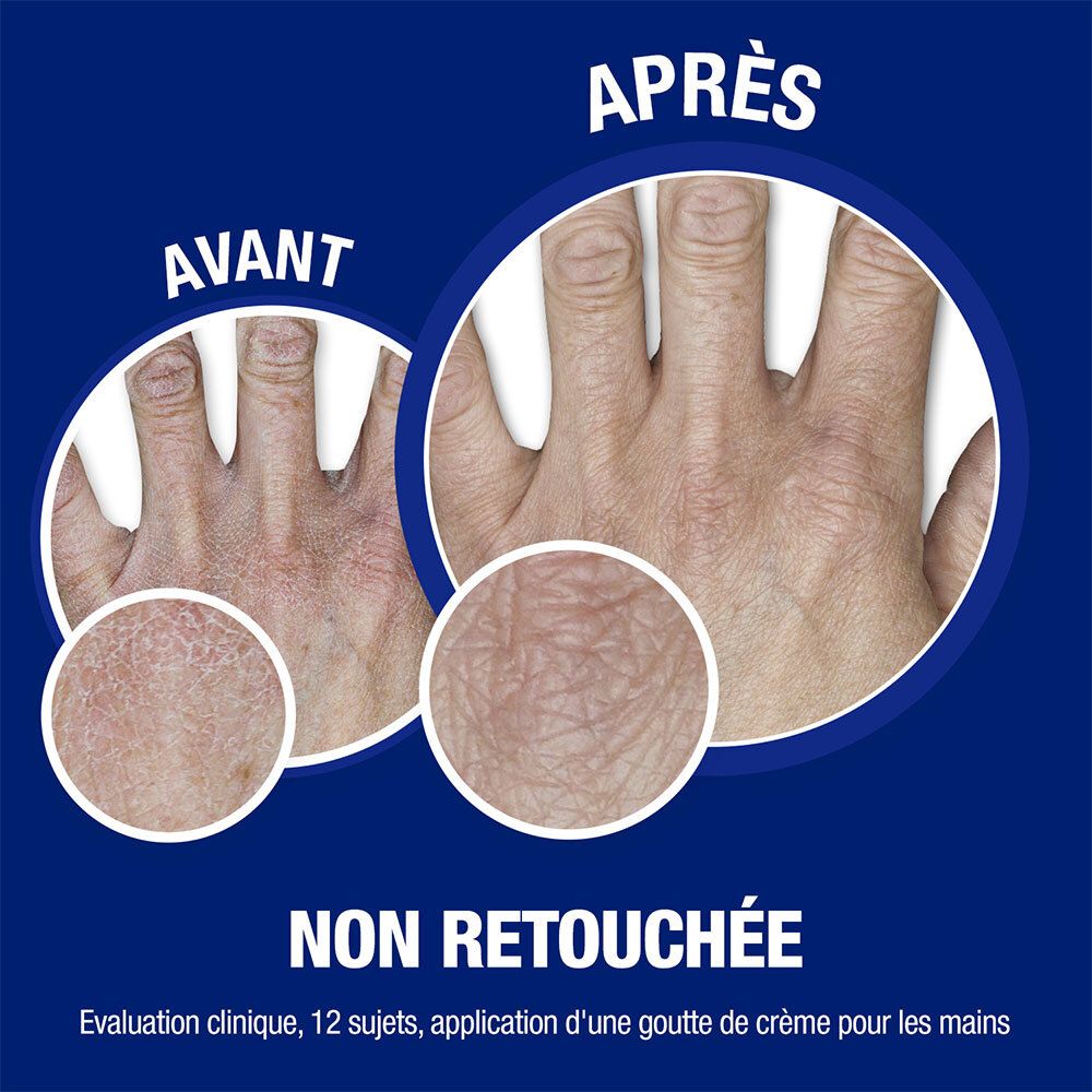 Comparaison mains: Avant/Après. Peau avec et sans application. Texte: Non retouchée. Évaluation clinique.
