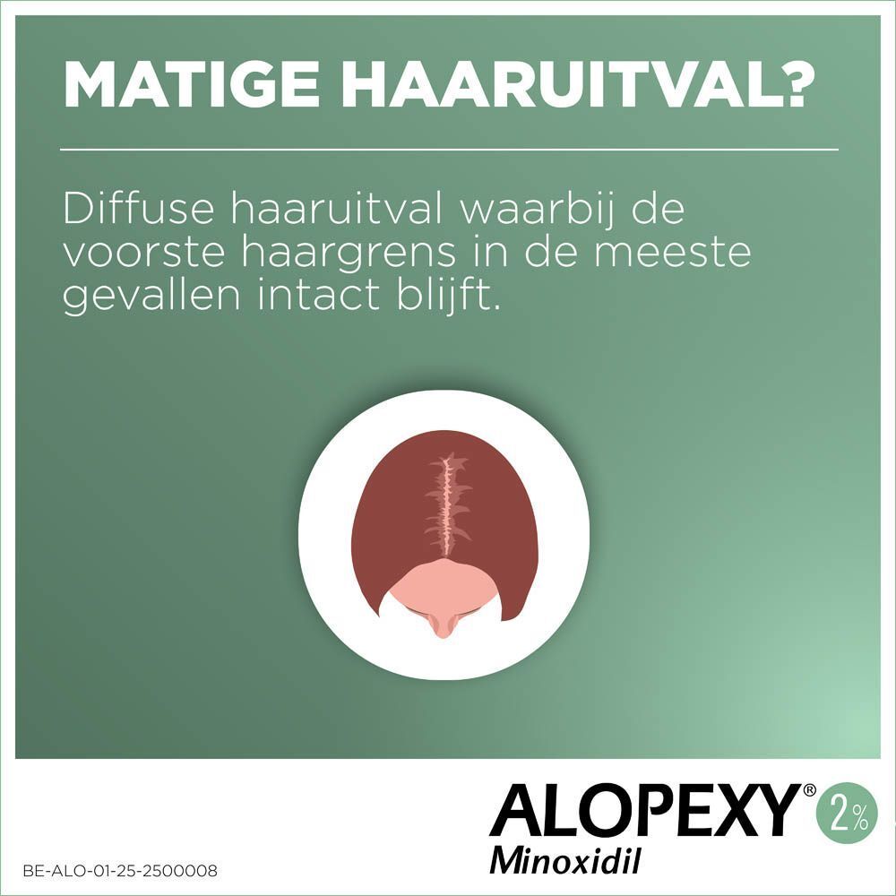 ALOPEXY 2% | Oplossing Minoxidil Voor Matige Alopecia Androgenetica Bij Volwassen Mannen En Vrouwen