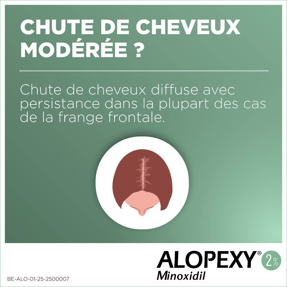 Boîte ALOPEXY 2%. Solution cutanée. Texte sur l'emballage.