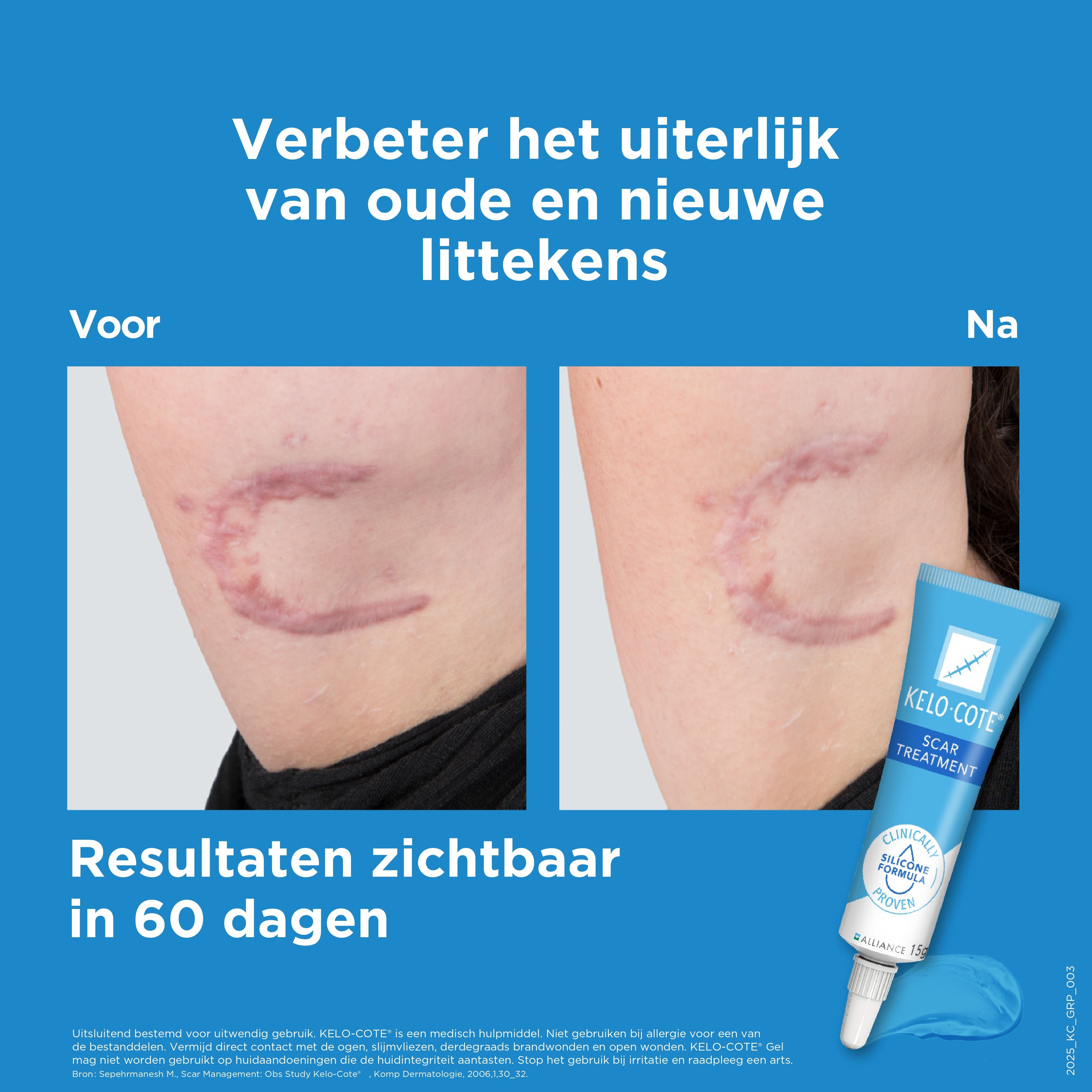 Kelo-Cote Silicone Littekengel