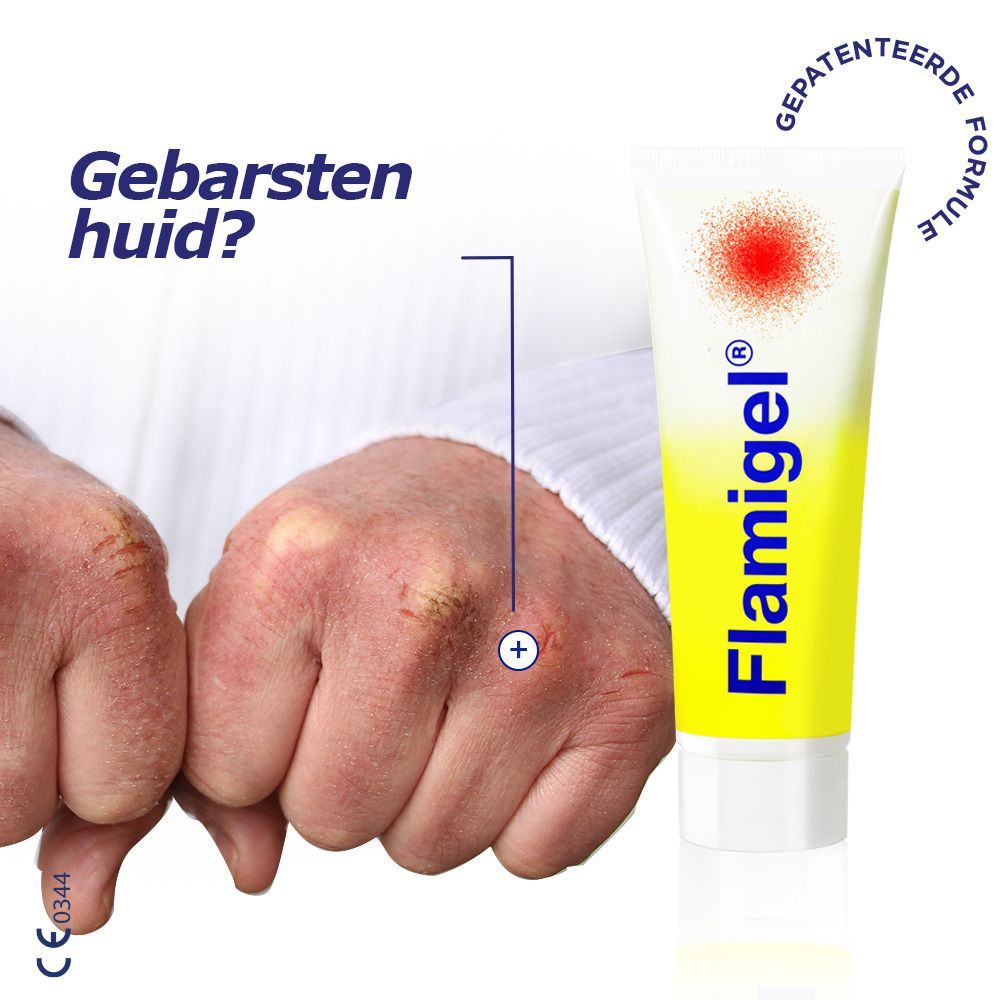 Flamigel® gel tube. Tube met gele achtergrond en rode stip. Vraag: Gebarsten huid?
