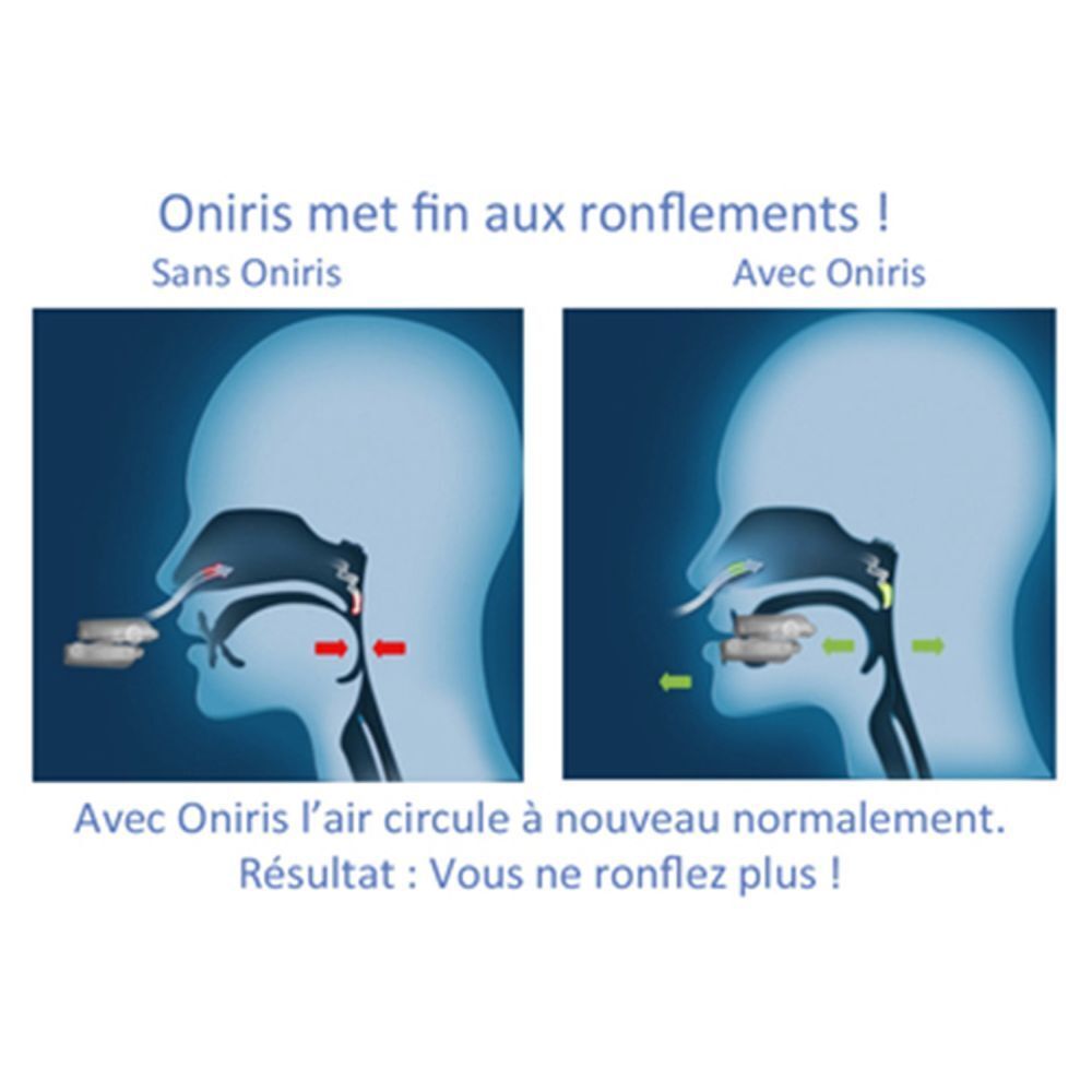 Dos de la boîte Oniris. Dispositif anti-ronflement et apnée du sommeil. Résultats. Marque Oniris.