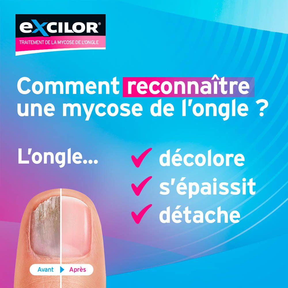 Flacon Excilor Forte, bouchon noir. Logo bleu. Inscription: Excilor.