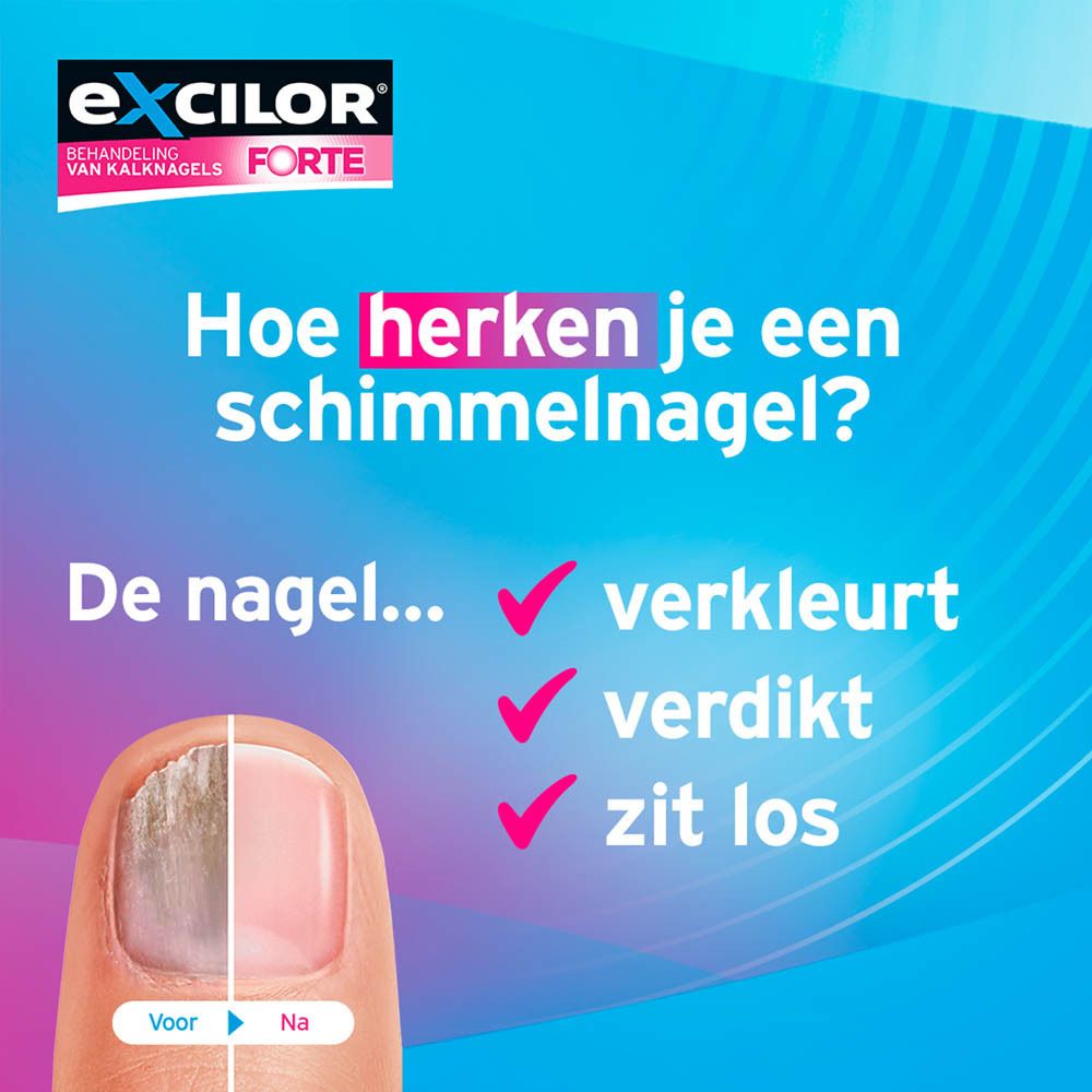 Excilor Forte fles met zwarte dop. Label met CE-markering en druppel.