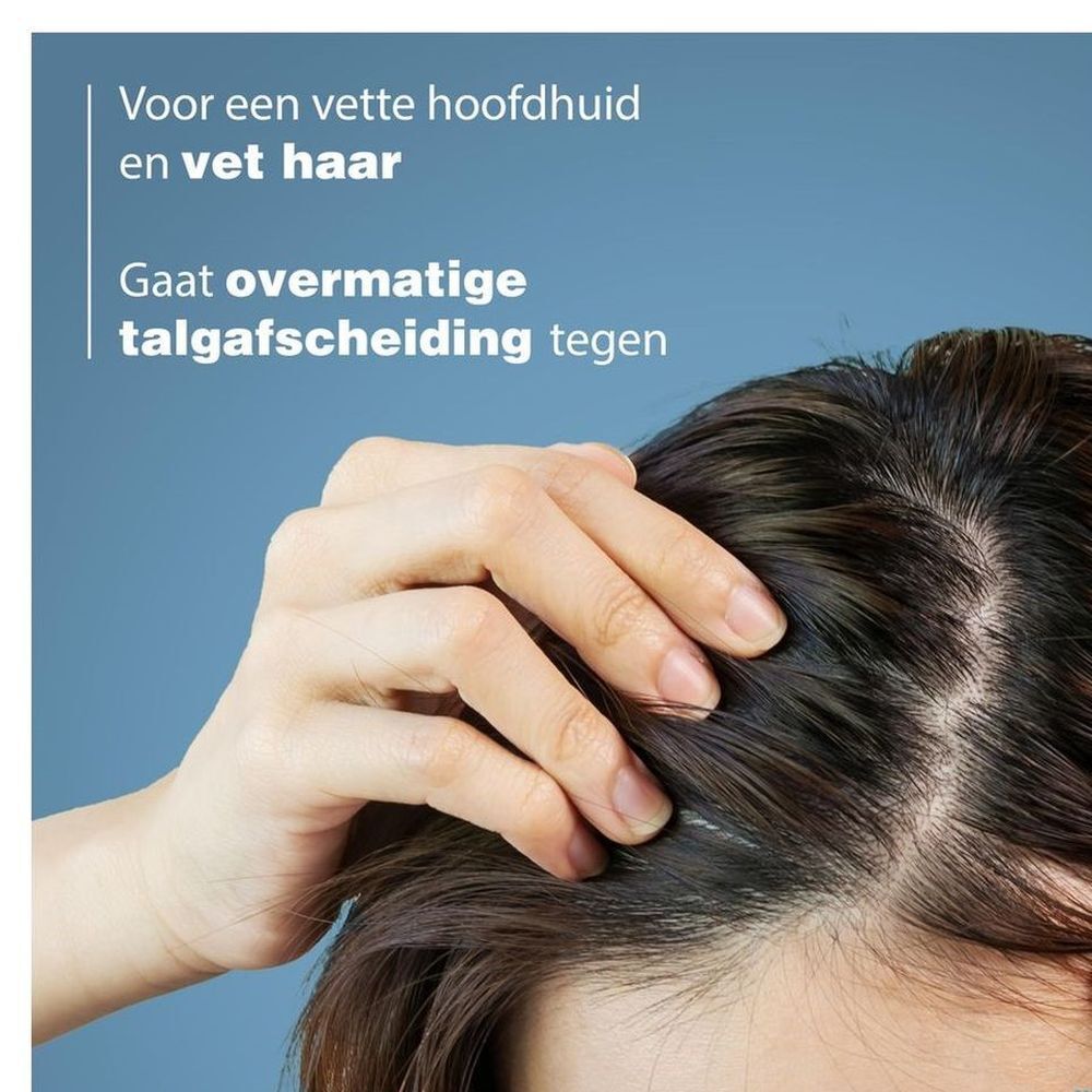 Close-up van een hand op een vette hoofdhuid. Tekst: Gaat overmatige talg afscheiding tegen.
