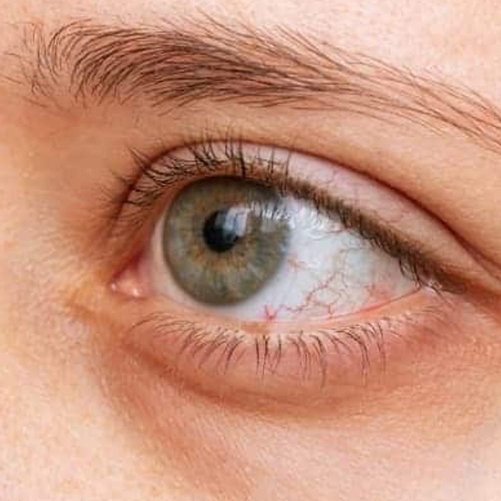 Close-up van een oog met rode bloedvaten. Huid rond het oog zichtbaar.