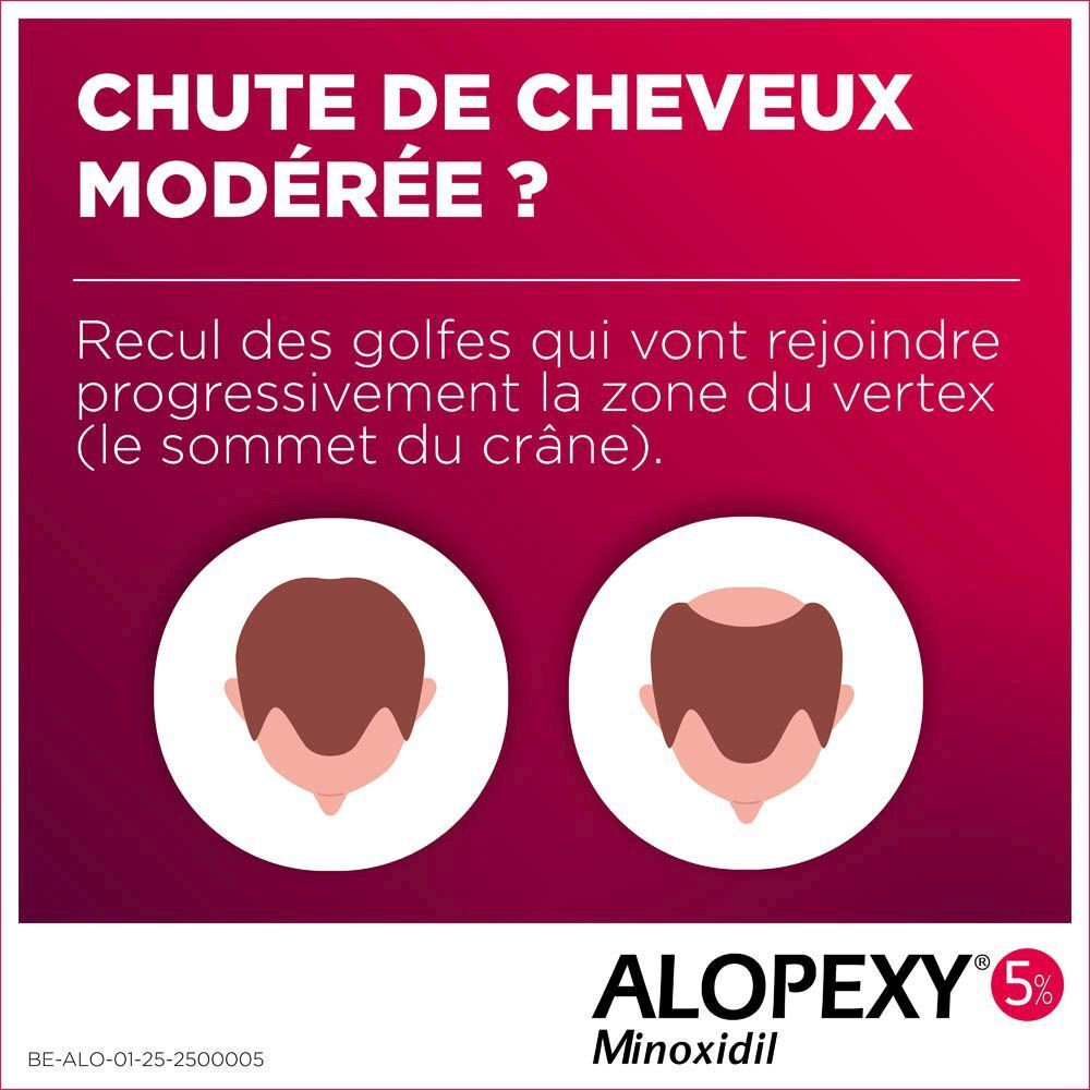 ALOPEXY 50MG/ML | Solution Minoxidil Pour Alopécie Androgénétique d’Intensité Modérée Homme Adulte
