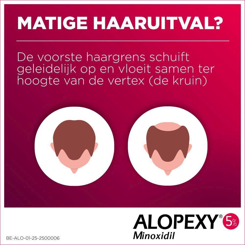 ALOPEXY 5% bijsluiter. Tekst in het Nederlands. Toont verschillende stadia van haaruitval.