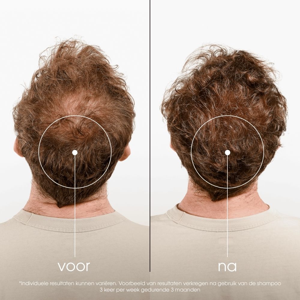KLORANE Shampoo Kinin & Edelweiss Bio, voorkant, 100 ml.