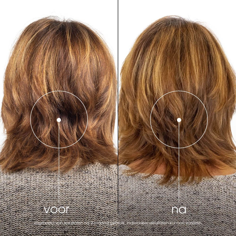 Voor- en na foto van haar. Haar met highlights.