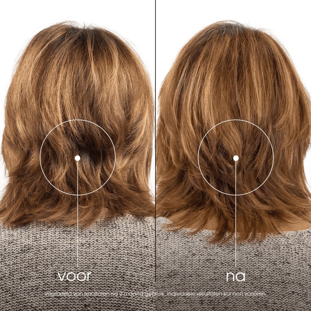 Achterkant van een Klorane conditioner granaatappel tube, 200ml. Bevat ingrediënten en instructies.