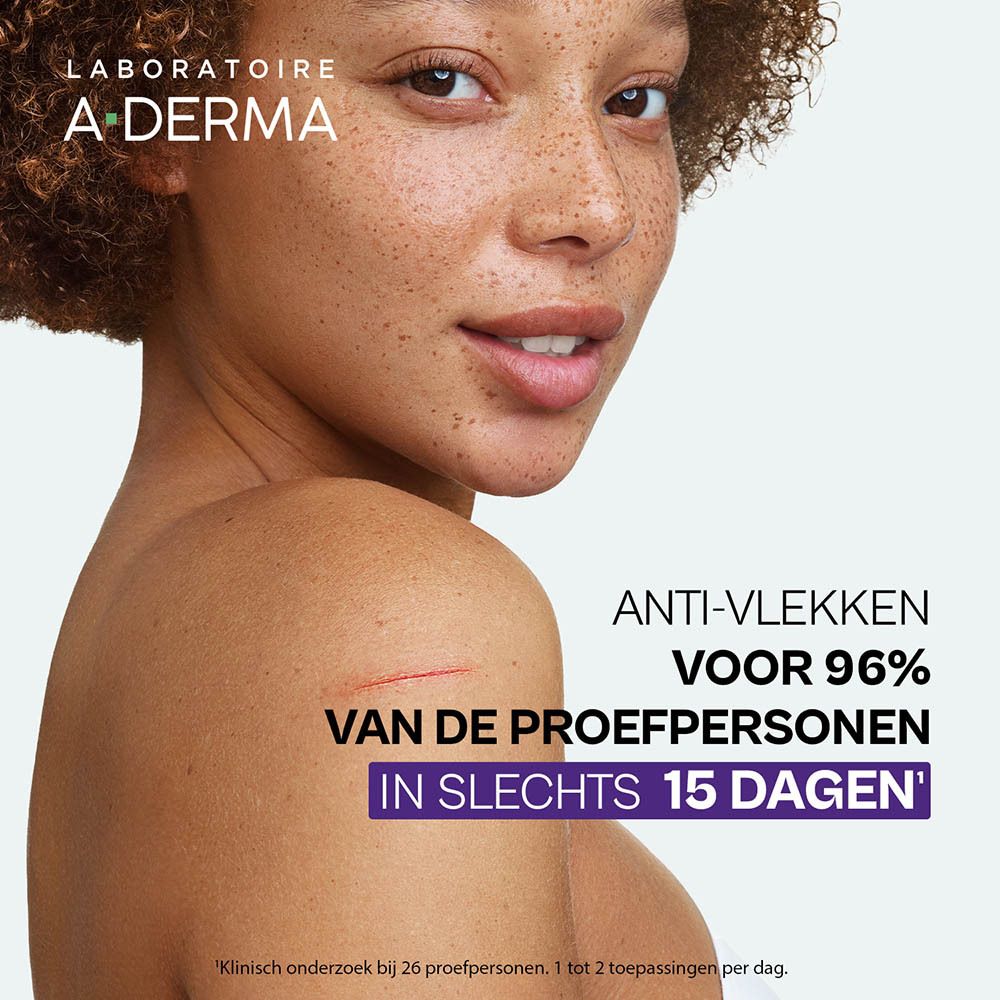 Vrouw met littekens op schouder. Tekst: Anti-vlekken voor 96% van de proefpersonen.