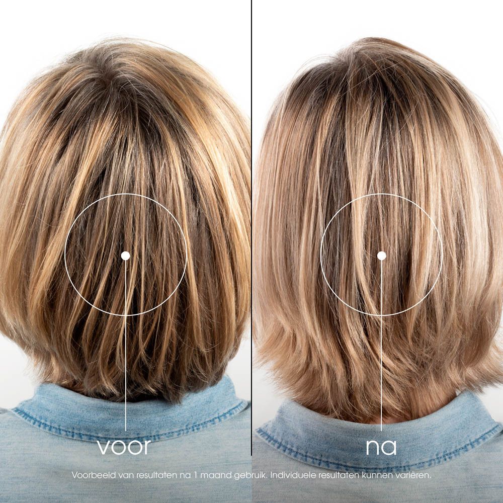 Voor-en-na foto van blond haar. Tekst: resultaten na 1 maand gebruik.