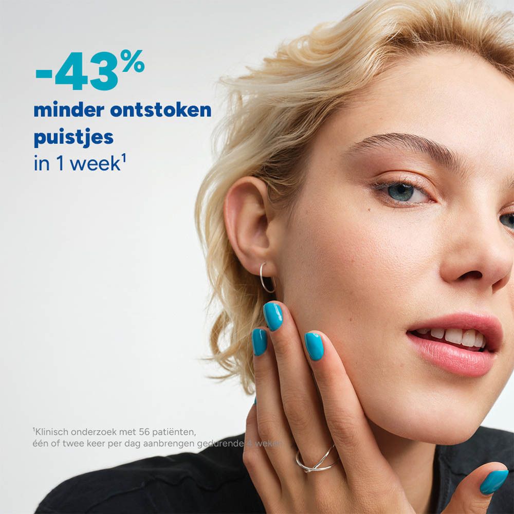 Vrouw raakt haar gezicht aan. Tekst: -43% minder ontstoken puistjes in 1 week. Studie met 56 patiënten.