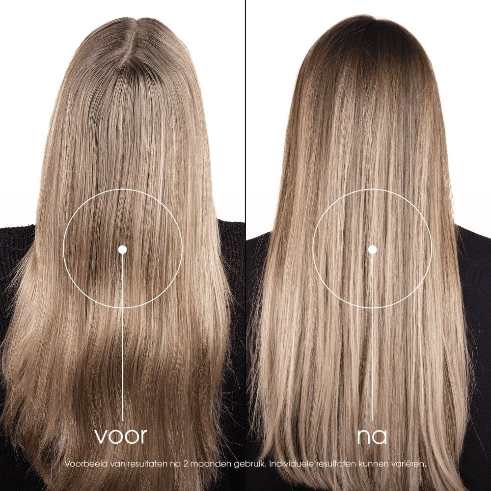 KLORANE Kamille BIO Haarspoeling: Maakt haar lichter en herstelt glans.