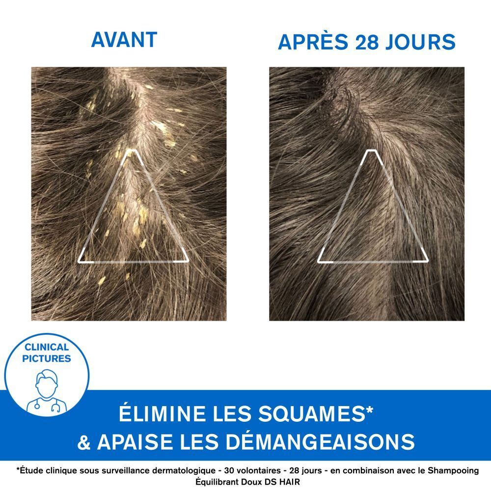 Uriage DS Hair Shampooing Traitant Kératoréducteur