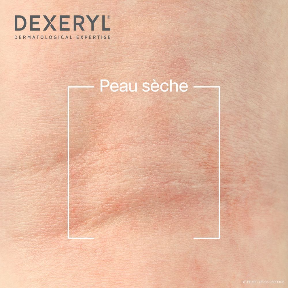 Tube de Dexeryl Crème. Tube blanc avec texte bleu. 50g. Dispositif médical.