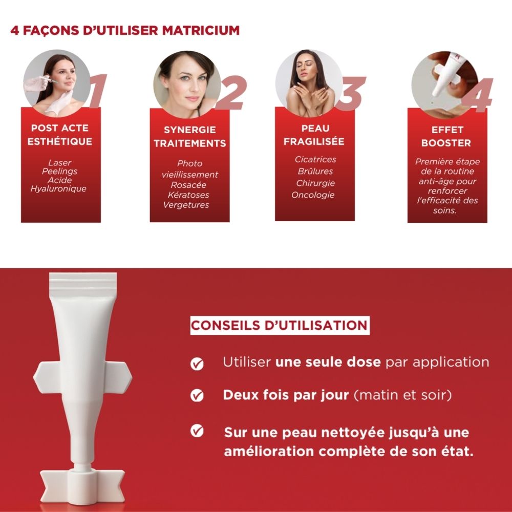 Graphique avec 4 façons d'utiliser Matricium. Produit et exemples d'utilisation. Design rouge.