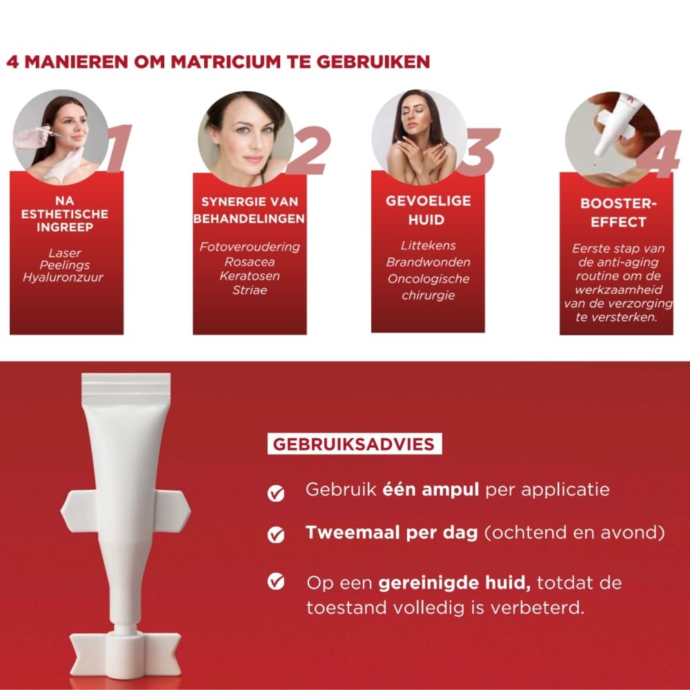 Grafiek met 4 manieren om Matricium te gebruiken. Product en voorbeelden van gebruik. Rood ontwerp.