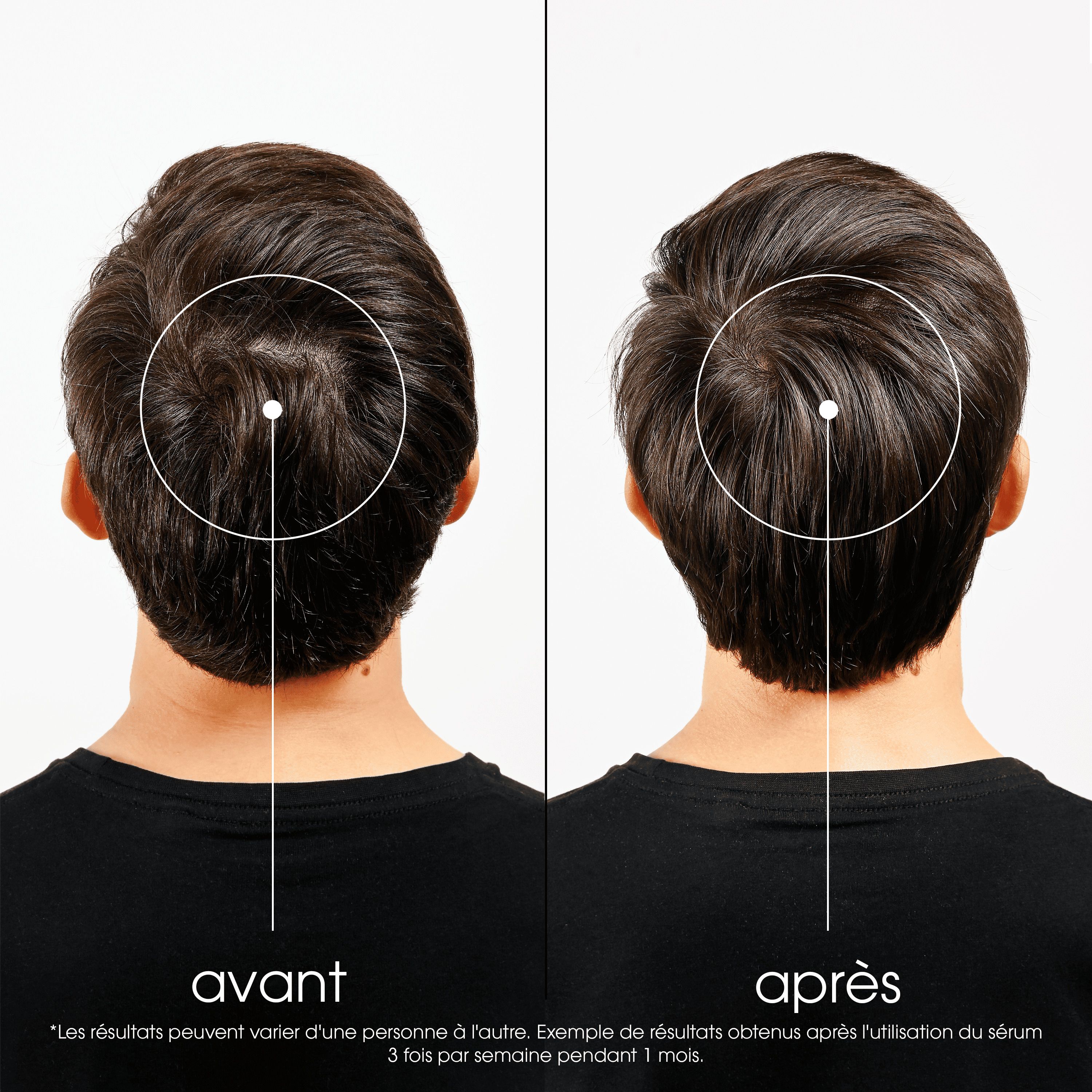 Flacon marron avec applicateur. Inscription: Klorane, Antichute, Anti-Hair Loss.