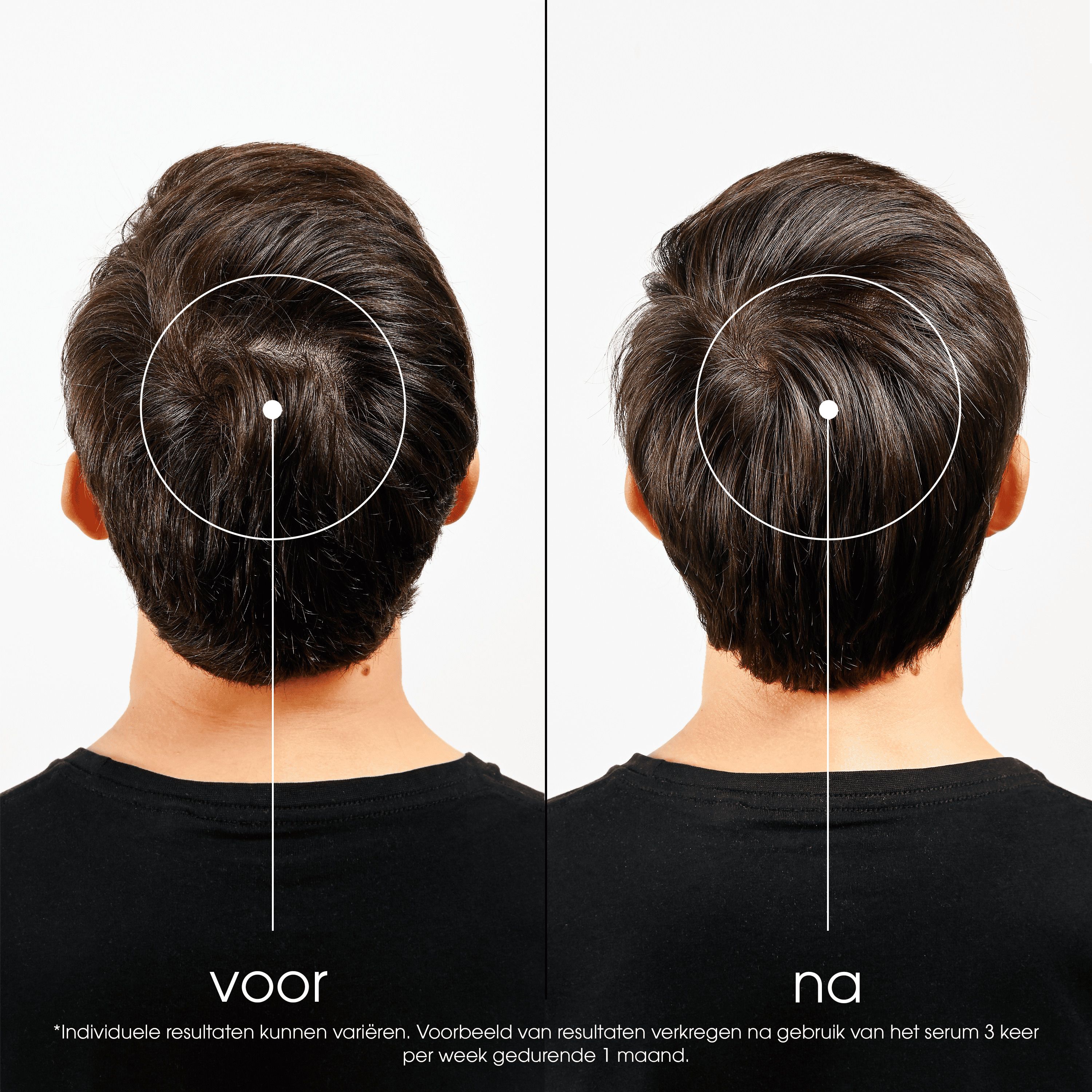 Bruine fles met sproeikop. Opschrift: Klorane, Antichute, Anti-Hair Loss.