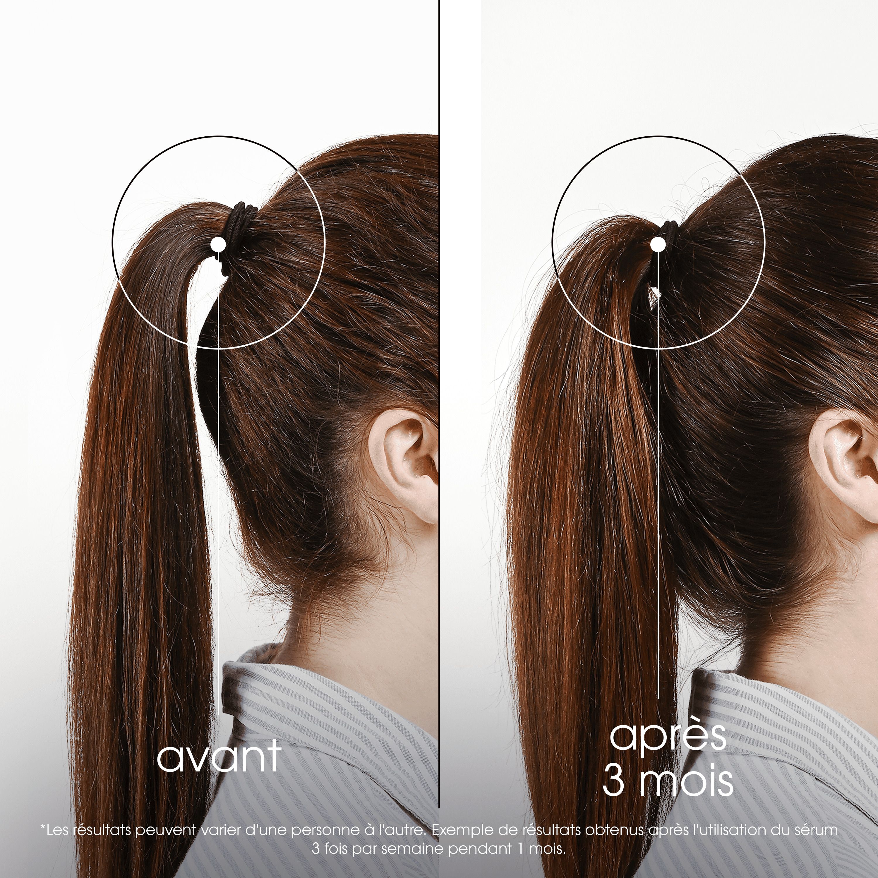 Flacon marron avec applicateur. Inscription: Klorane, Antichute, Anti-Hair Loss.