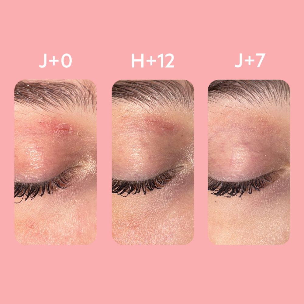 SVR Palpebral Balsem 30ml
