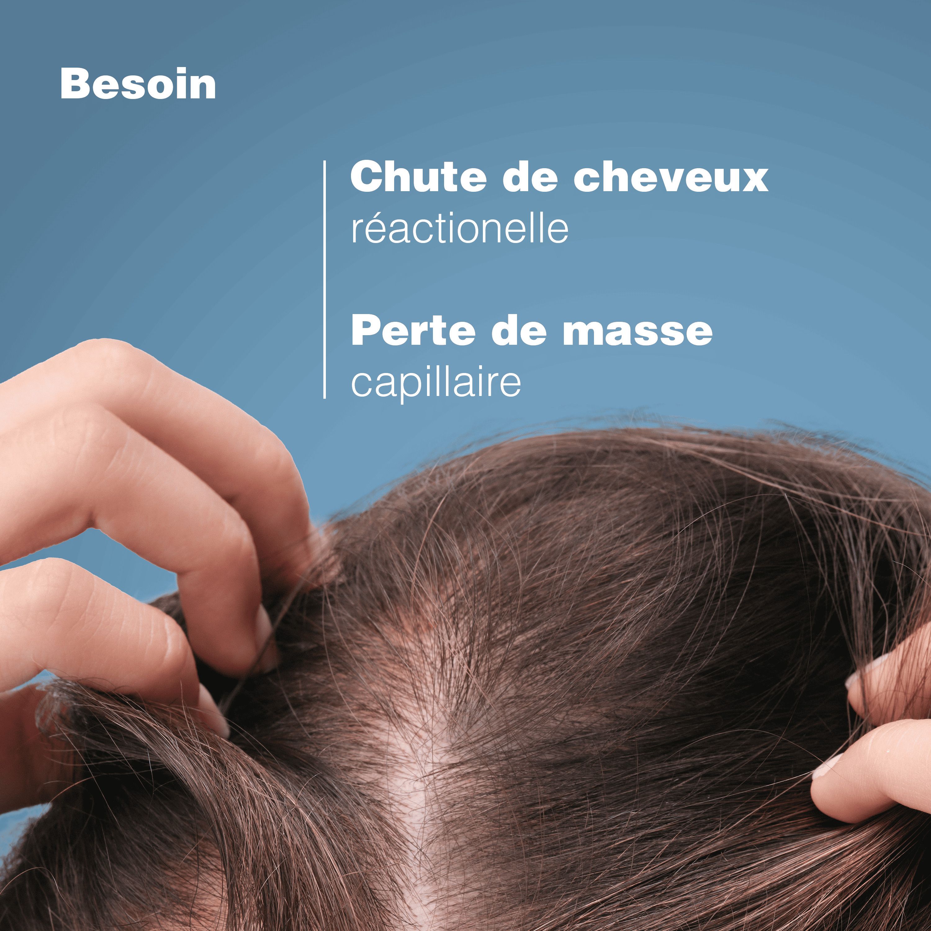 Gros plan sur le cuir chevelu et les cheveux. Texte: Besoin: Chute de cheveux réactionnelle, perte de masse capillaire.