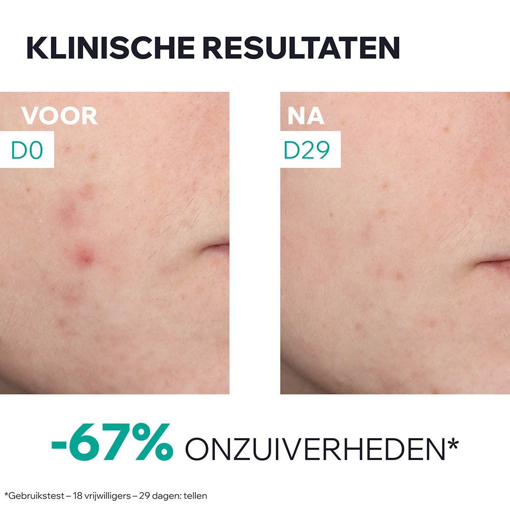 Uriage Hyséac serum. Fles met witte dop. Productlabel met tekst.