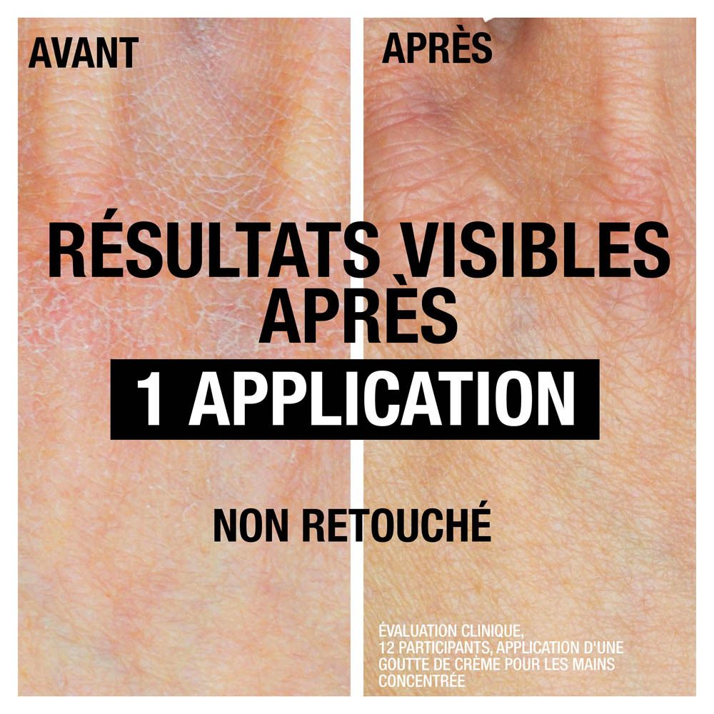Comparaison avant/après. Peau sèche avant et après la crème. Résultats visibles après 1 application.