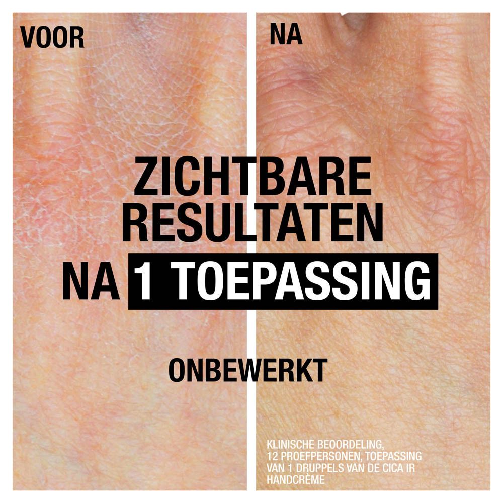 Voor/na vergelijking. Droge huid voor en na crème. Zichtbare resultaten na 1 toepassing.