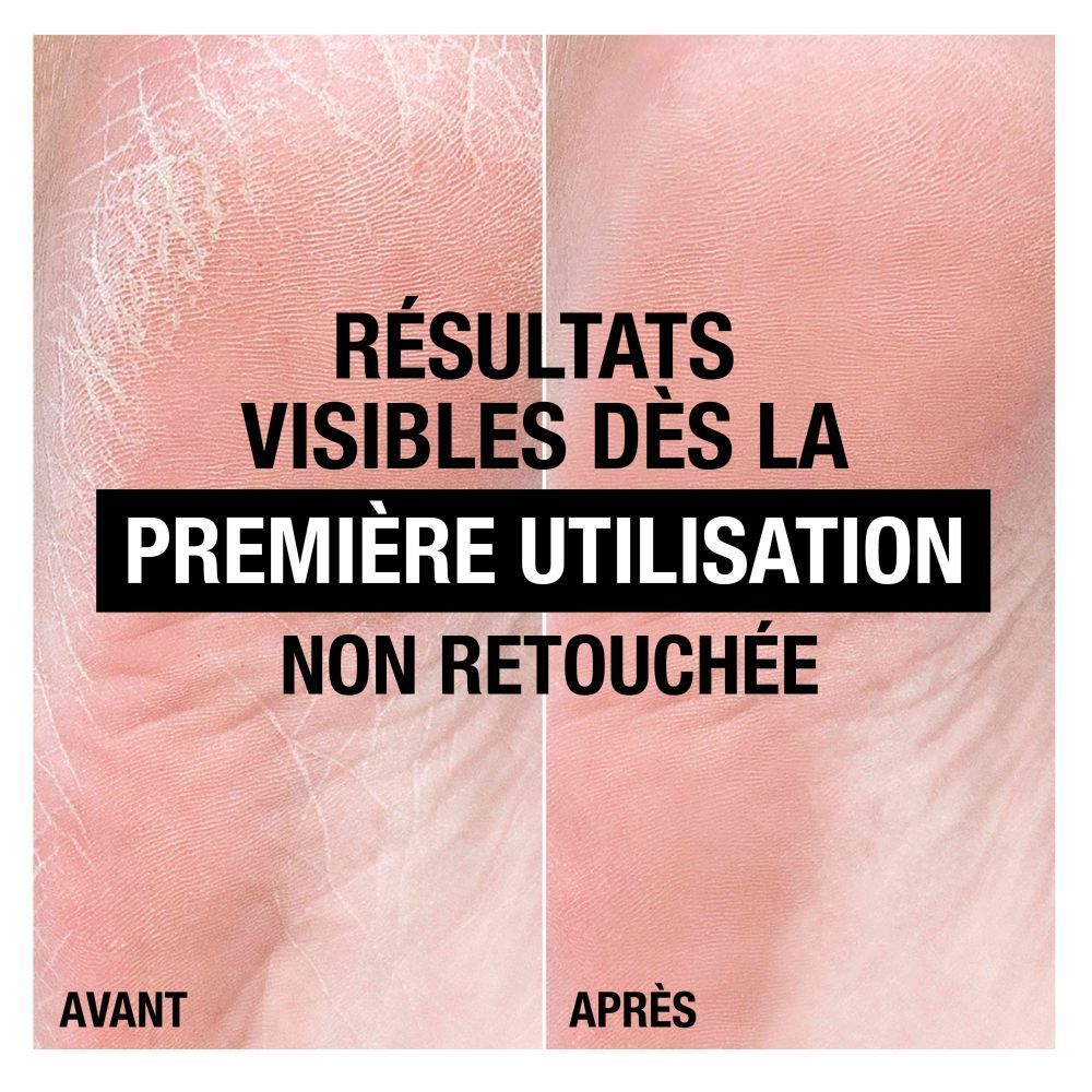 Avant-Après des pieds. Texte: Résultats visibles dès la première utilisation. Non retouchée.