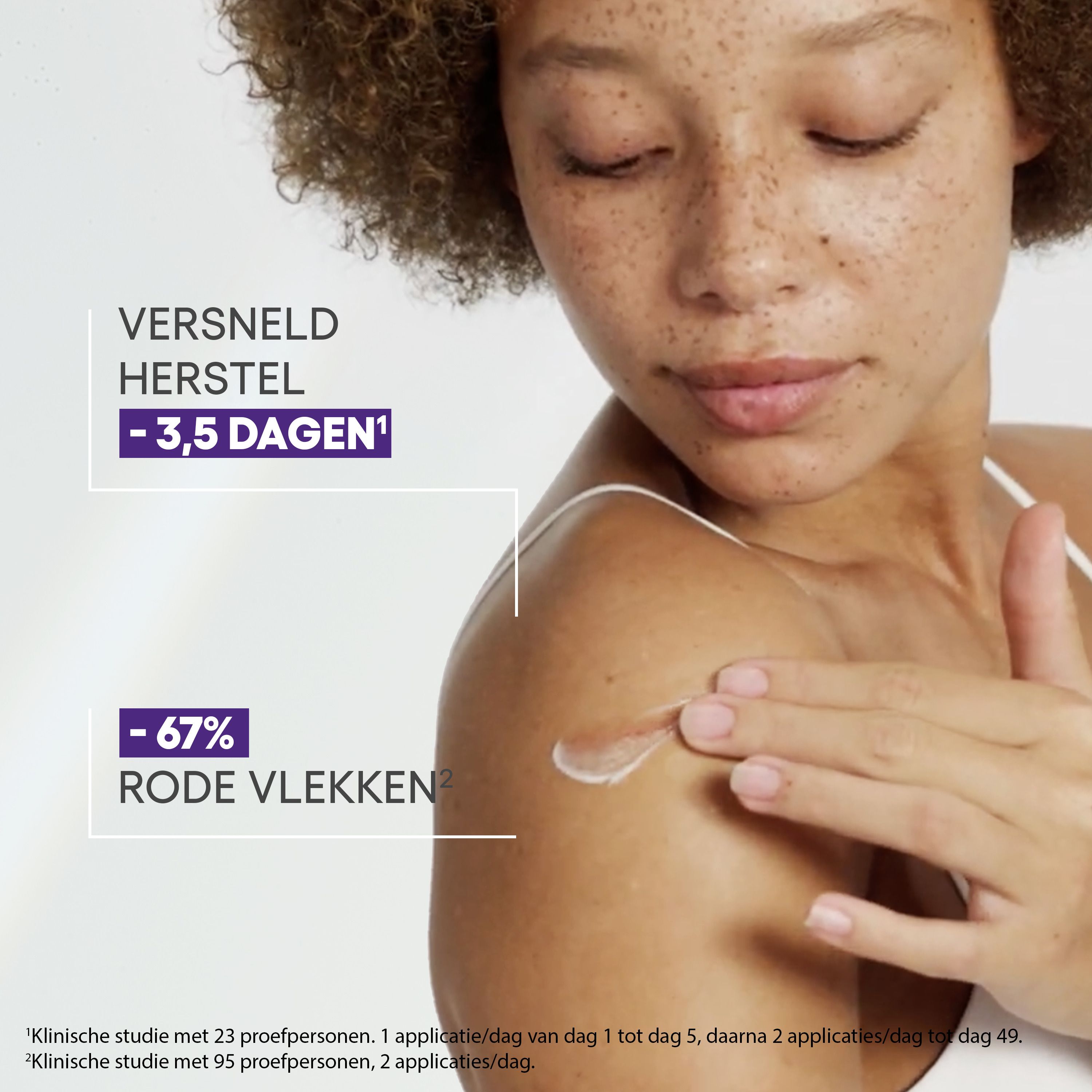 Vrouw met crème op schouder. -3,5 dagen. -67% rode vlekken.