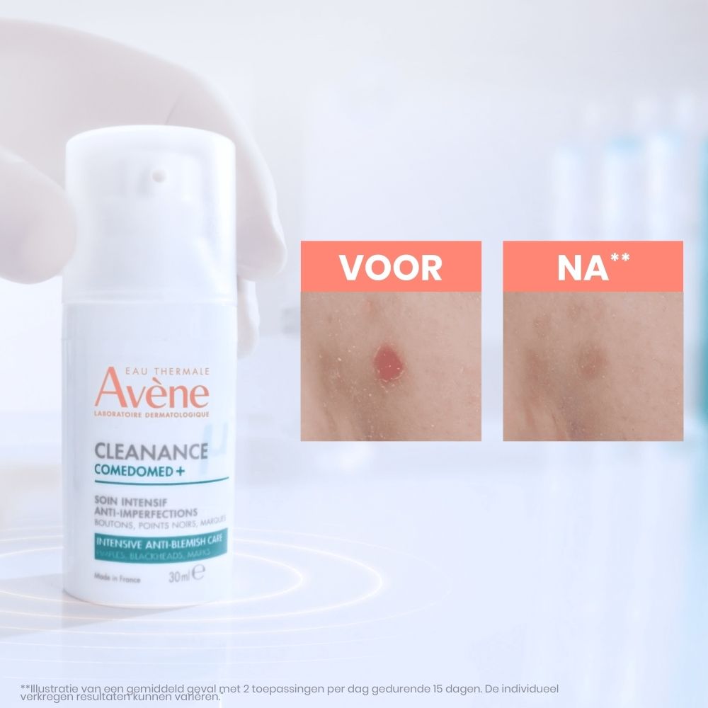 Avène Cleanance Comedomed+ fles. Wit, met doseerkop. Tekst: Cleanance Comedomed+, 30ml.