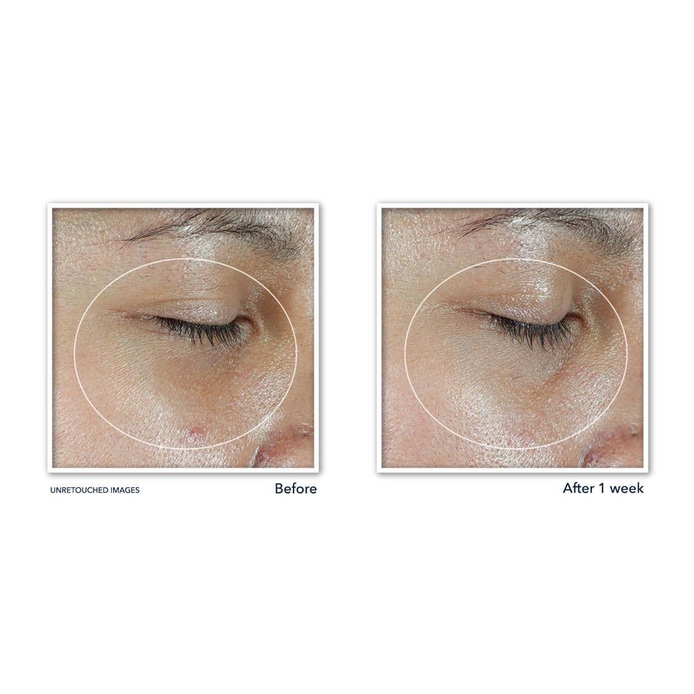 RoC Multi Correxion Renouveau + Éclat Baume Yeux