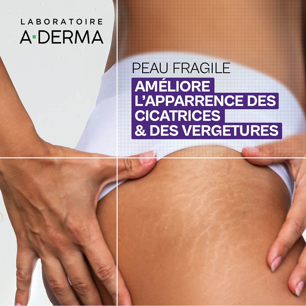 Femme avec vergetures. Texte: Améliore l'apparence des cicatrices et vergetures.