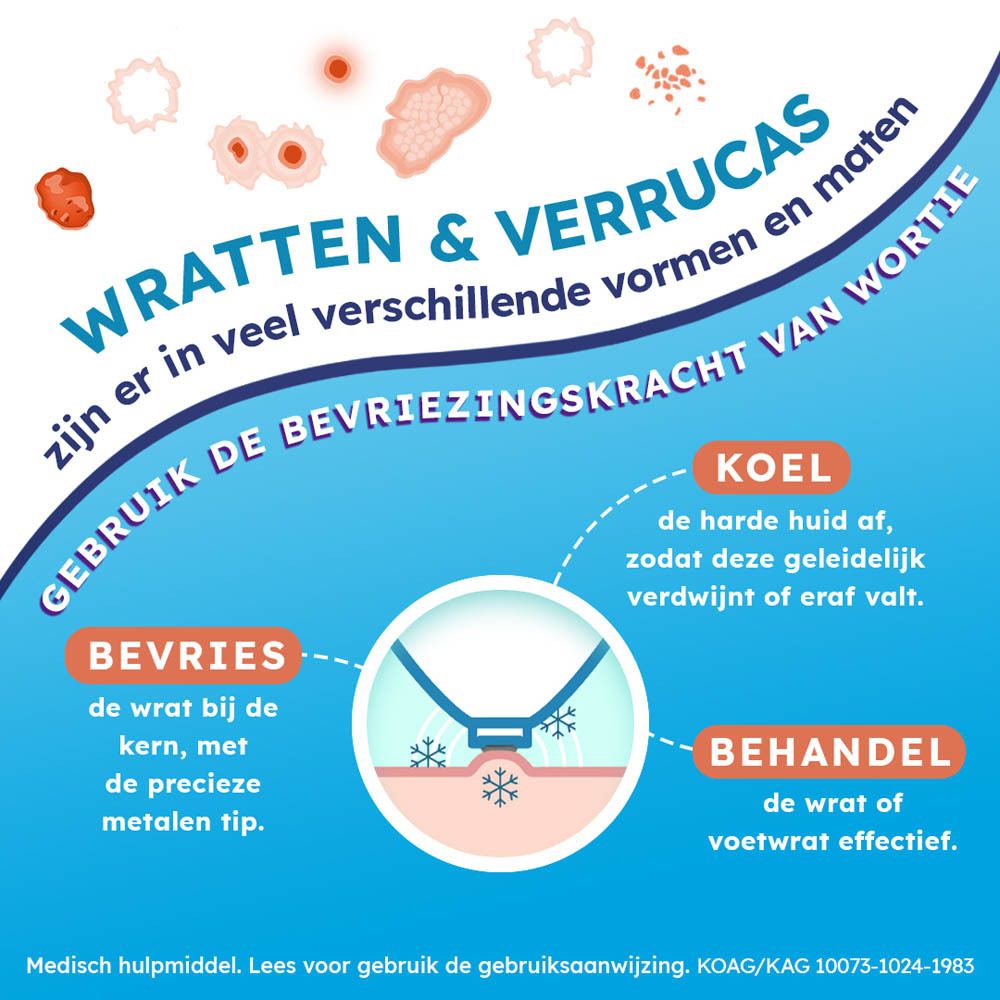 Wortie Freeze Wratten & Voetwratten Verwijderaar
