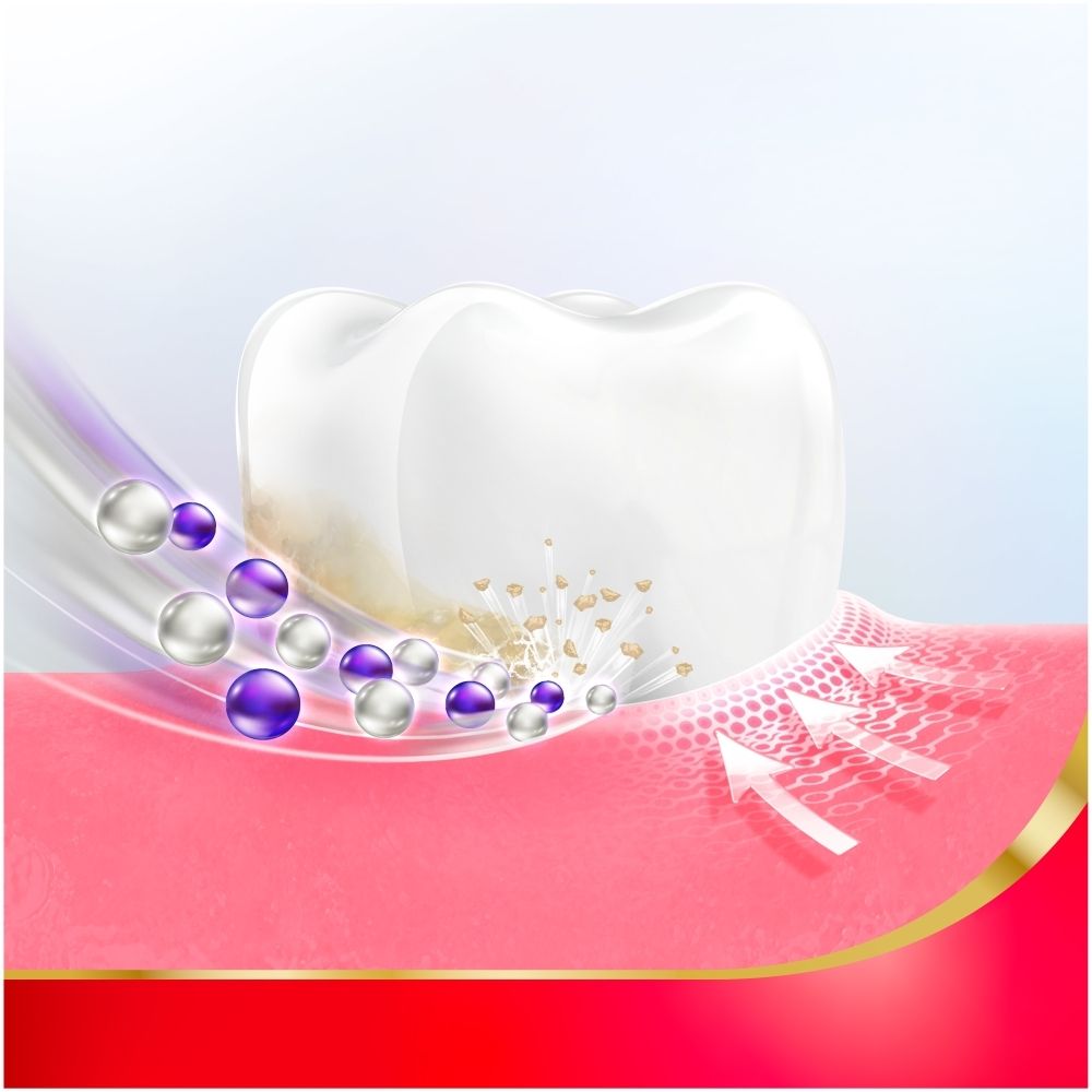 Dent avec gencive et particules flottantes indiquant une couche protectrice.