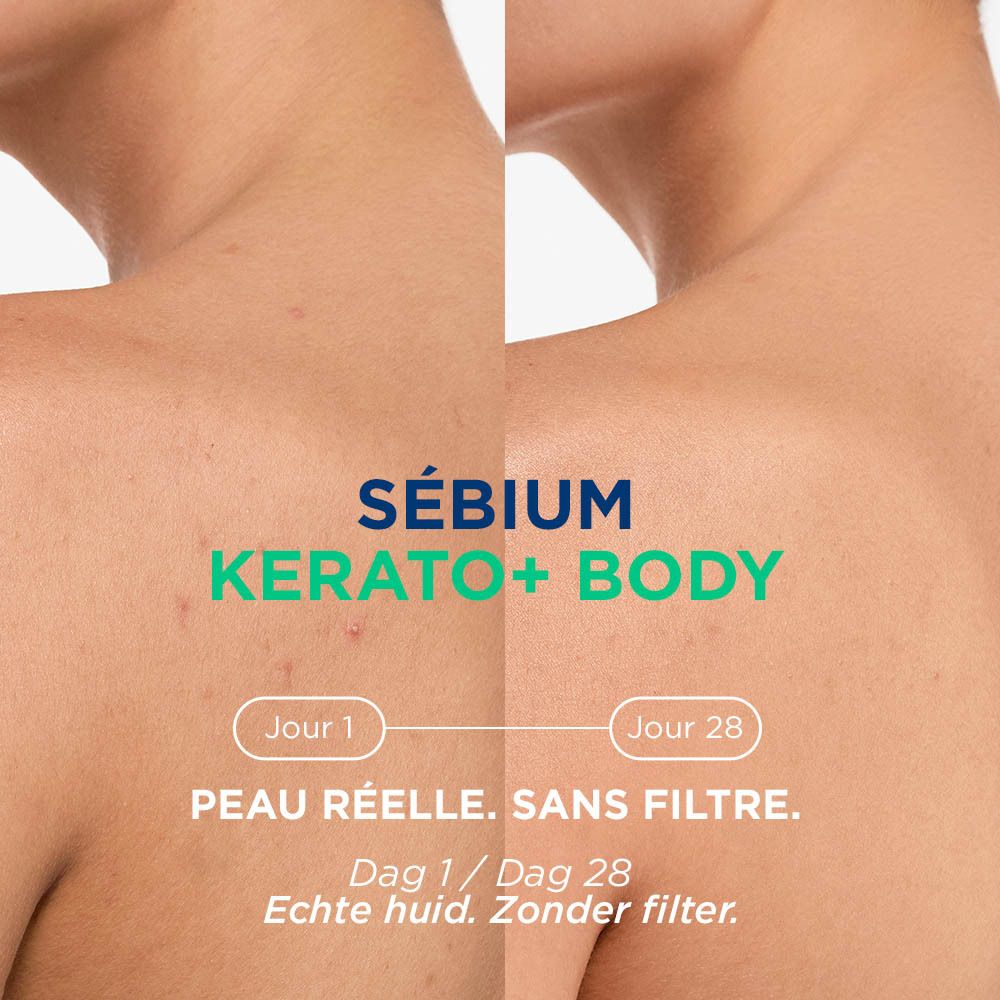 Vergelijking voor/na 28 dagen. Tekst: Sébium Kerato+ Body. Peau réelle. Sans filtre.