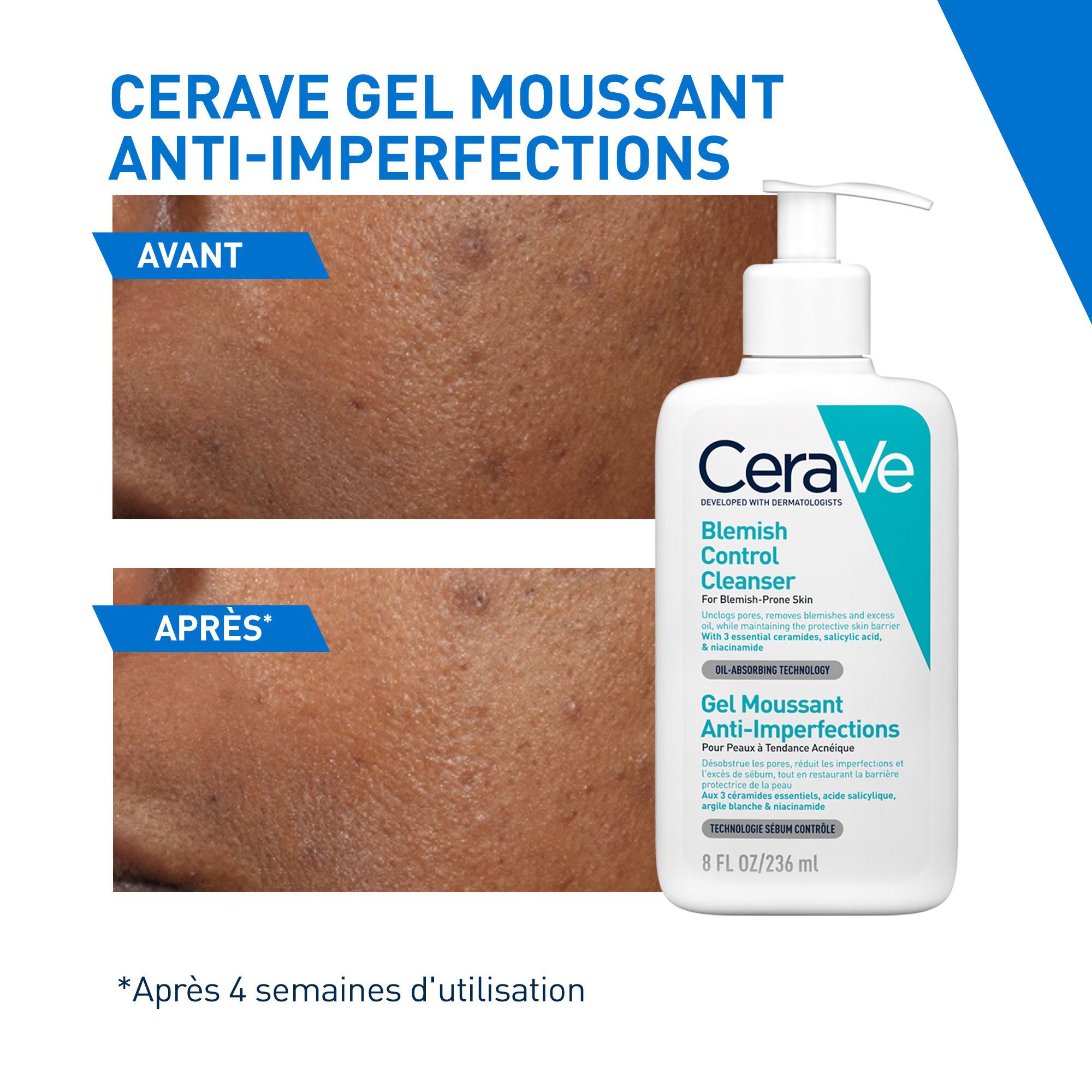 CeraVe Gel Moussant Anti-Imperfections