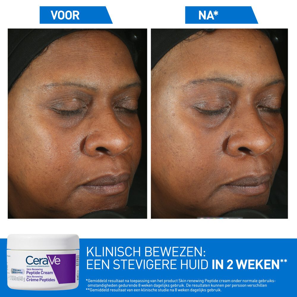 Voor- en na-foto's van een gezicht. Tekst: CeraVe Skin Renewing Peptide Cream. Resultaten in 2 weken.