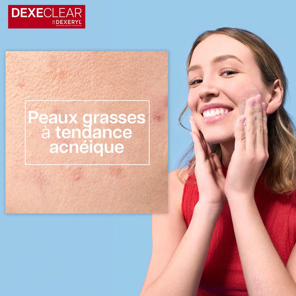 Peau acnéique. Peaux grasses à tendance acnéique. Femme se lave le visage.