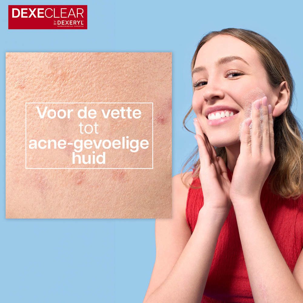 Vrouw met acne-huid. Tekst: Voor de vette tot acne-gevoelige huid.