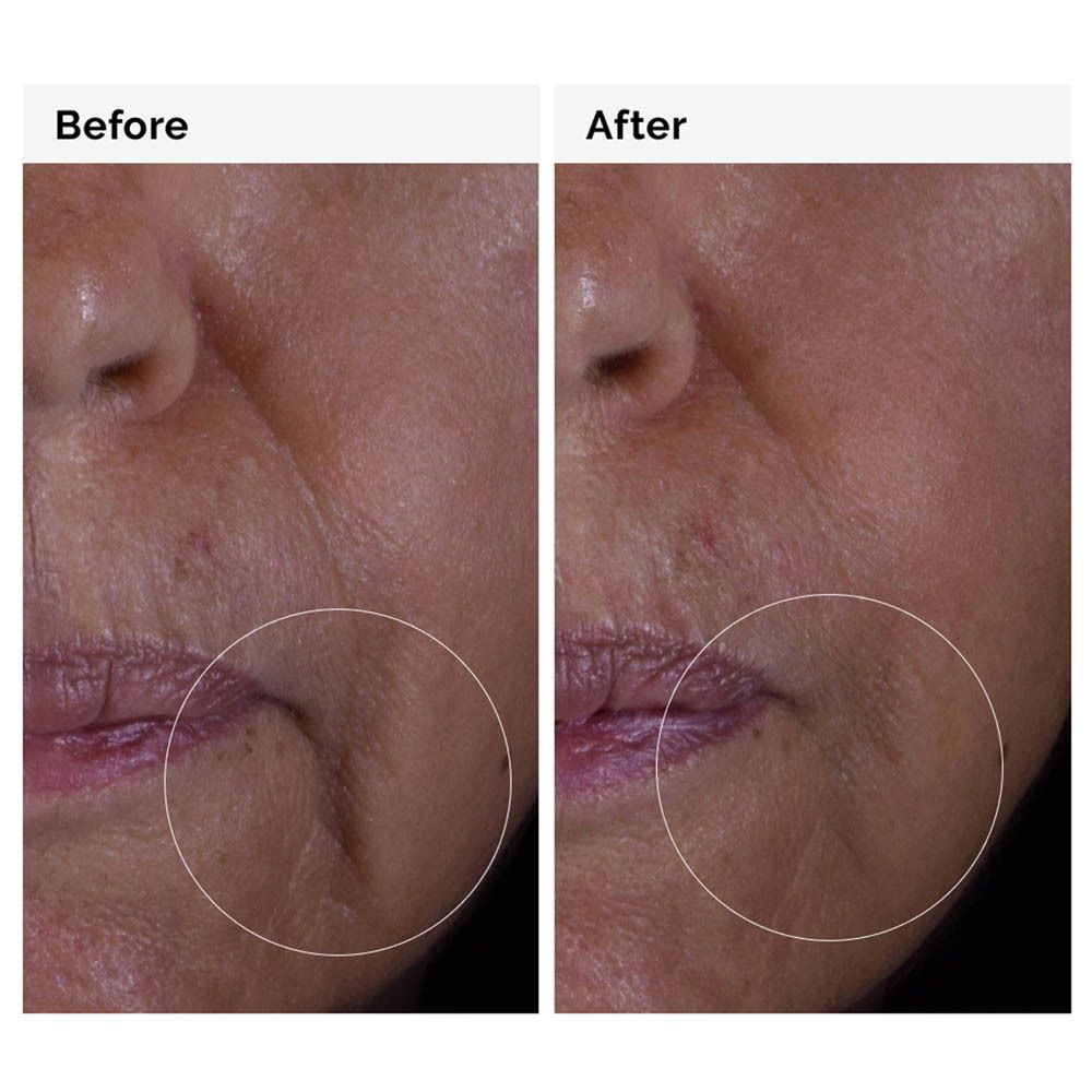The Ordinary GF 15% Solution Serum